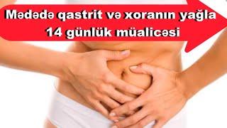 Mədədə qastrit və xoranın yağla- 14 günlük müalicəsi