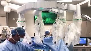 Why the transition from laparoscopy to robotics