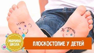 Плоскостопие у детей. Диагностика и лечение