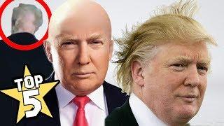 TOP 5 | DONALD TRUMP'S BALD SPOT SHOCKING FACTS