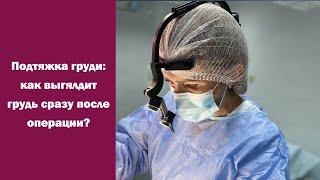 Результат подтяжки груди без имплантов: Как выглядит грудь сразу после операции?