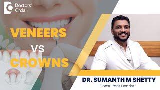 Crowns Vs Veneers - Which one is the best? #dentalcrowns   - Dr. Sumanth M Shetty | Doctors' Circle