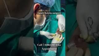 Laser fistula surgery I लेजर फिस्टुला ऑपरेशन I Fistula in ano