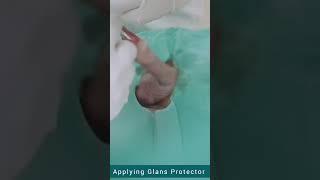 ZSR Circumcision Surgery Step-by-Step | Best Results in Jaipur | Dr. Deepesh Goyal