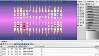 Tooth Chart Fixers Session