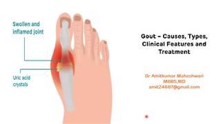 Gout - Types, Clinical Features and Treatment || Hyperuricemia || Uric Acid || Biochemistry