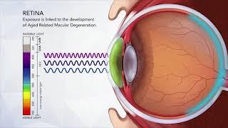 The Effect of High Energy Light HEV