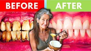 "FIX YOUR TEETH AFTER 50!" NATURAL Dental Treatment That Actually Works! | Barbara O'Neill