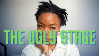 The Ugly Stage | How to Deal with the Ugly Stage of Locs