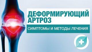 Деформирующий артроз: симптомы и методы лечения