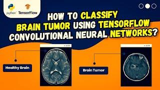 Ai Brain Tumor | Brain Tumor Classification using Deep Learning