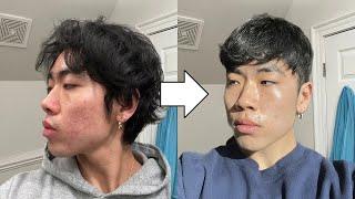 Skincare Fundamentals for Asian Men