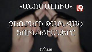 Ձեռքերի թաքնված ֆունկցիաները․ «Անոմալուս» Կարեն Եմենջյանի հետ