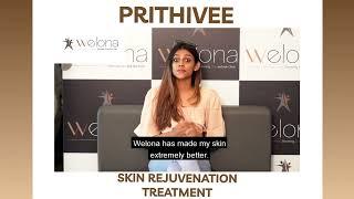 Skincare Q&A with model Prithivee and her experience with welona | Skin Rejuvenation Treatment