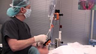 Video Laryngoscope stylet intubation