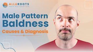 Causes and Diagnosis of Male Pattern Hair Loss | Explained by Dr Alok Sahoo | @alloroots