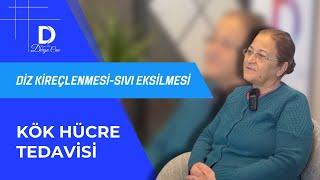 Diz Kireçlenmesi - Sıvı Eksilmesi - Menisküs Yırtığı Ameliyatsız Karın Yağı Kök Hücre Tedavisi