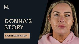 Patient testimonial | Full Laser Skin Resurfacing | Donna's Story