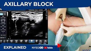 Ultrasound Guided Axillary Brachial Plexus Block NYSORA Regional Anesthesia