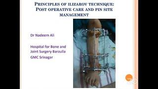 Principle of Ilizarov Technique: Post Operative Care & Pin Site Management -Dr Nadeem Ali