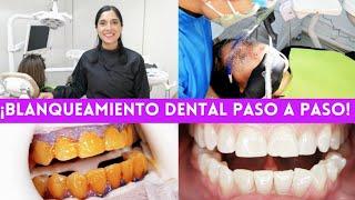 ¡ASÍ SE HACE UN BLANQUEAMIENTO DENTAL! | TE MUESTRO EL PASO A PASO  #blanqueamientodental