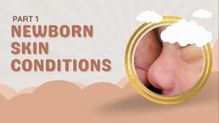 Newborn Skin Conditions