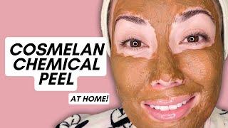 Cosmelan Chemical Peel at Home for Dark Spots: My Experience & Results