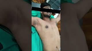 Gynecomastia Surgery cost | Gynecomastia Surgery cost | #shortvideo  #shots #dezireclinicindia