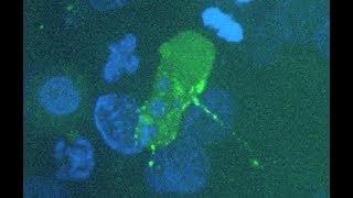 Caught on Camera: How HIV Infects Cells