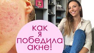 Как я победила акне! Моя история, Питание, Кето-Диета при Акне!