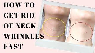 How to get rid of neck lines