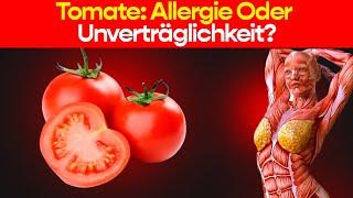 Sie Ignorieren Vielleicht Diese Tomatenallergie! Pflege