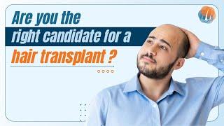 Are you the right candidate for a hair transplant? | Dr Alok Sahoo Explained | Alloroots