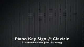 Piano Key Sign Clavicle