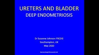 URETERS AND BLADDER: Deep Endometriosis