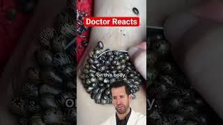 ER Doctor REACTS to Satisfying "Tick" Removal