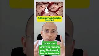 Gejala Awal Pecah Pembuluh Darah Otak atau Stroke Perdarahan yg berbeda dg Stroke Sumbatan