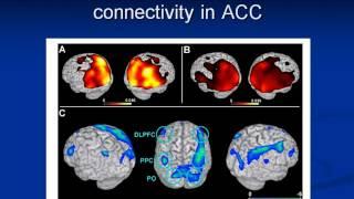 Brain Connectivity