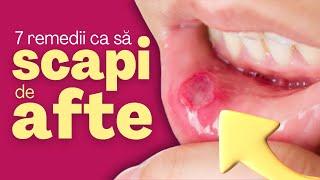 Cum scapi de AFTE: iată 7 Remedii NATURALE