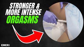 STRONGER, BETTER ORGASMS | VAGINAL REJUVENATION WITH FORMA V | Dr. Jason Emer