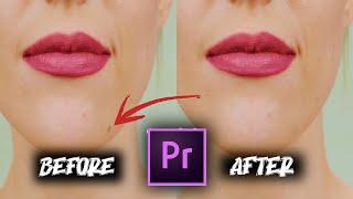 Easy Trick To Remove Dark Spot & Pimple In Adobe Premiere Pro