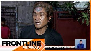 Lalaking nagpa-tattoo sa noo kapalit ang P100,000, nilinaw na hindi gimik ang sinalihang contest