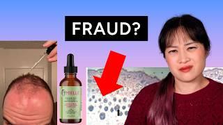 Rosemary oil and hair loss Pt 2: Scam like a scientist