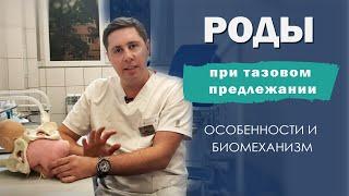 ТАЗОВОЕ предлежание плода |  роды | БИОМЕХАНИЗМ | причины | что НУЖНО знать