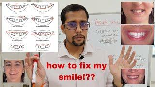 how to correct my smile! | smile check in 5 mins | smile correction