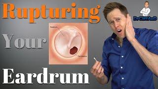 Ruptured Eardrum | Tympanic Membrane Perforations