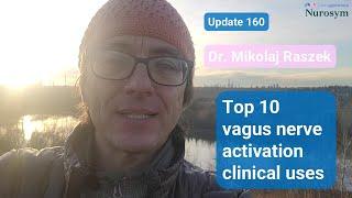 Top 10 vagus nerve activation clinical uses (#160)