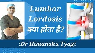 Lumbar Lordosis क्या होता है?