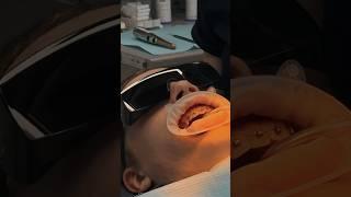 УСТАНОВКА БРЕКЕТ-СИСТЕМЫ стоматология Фамилия #dentist #smile #доктор #стоматология #краснодар