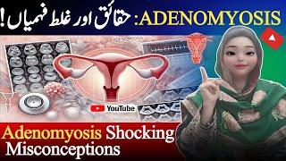 Adenomyosis: The Myths vs Facts You NEED to Know